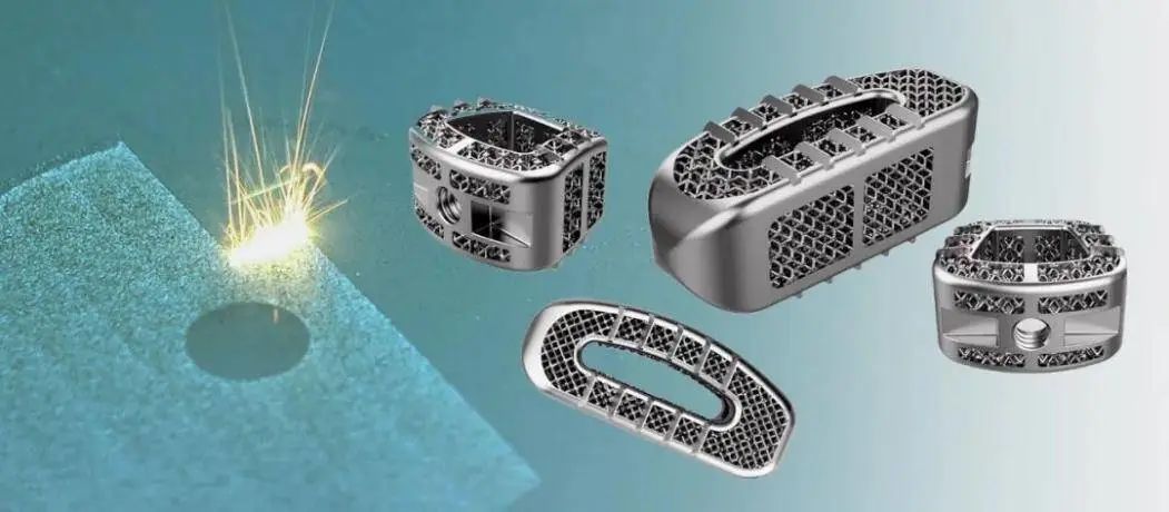 从术前导航到体内植入 医疗3D打印的十年跨越与衡器制造技术